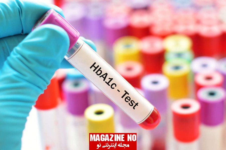 مخفف HBA1C در آزمایش چیست؟