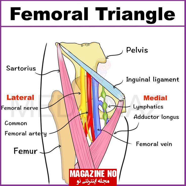 مثلث فمورال ران + آسیب‌ها و اختلالات مثلث فمورال