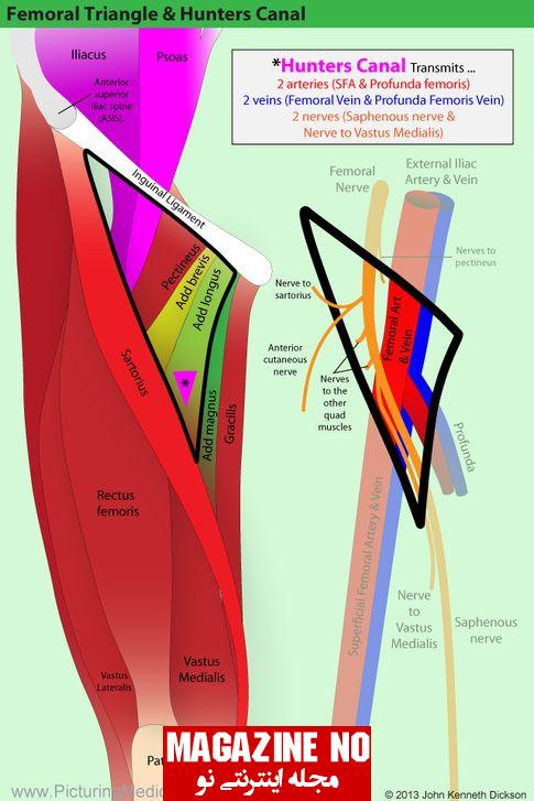 مثلث فمورال ران + آسیب‌ها و اختلالات مثلث فمورال