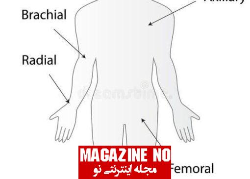 مثلث فمورال ران + آسیب‌ها و اختلالات مثلث فمورال