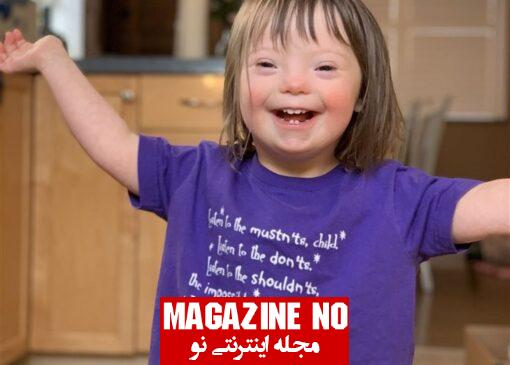 سندرم داون (Down syndrome): عوامل، انواع، علائم و درمان