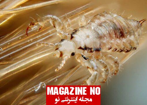 شپش (Louse) + علائم، نشانه‌ها و پیشگیری از آلودگی به شپش