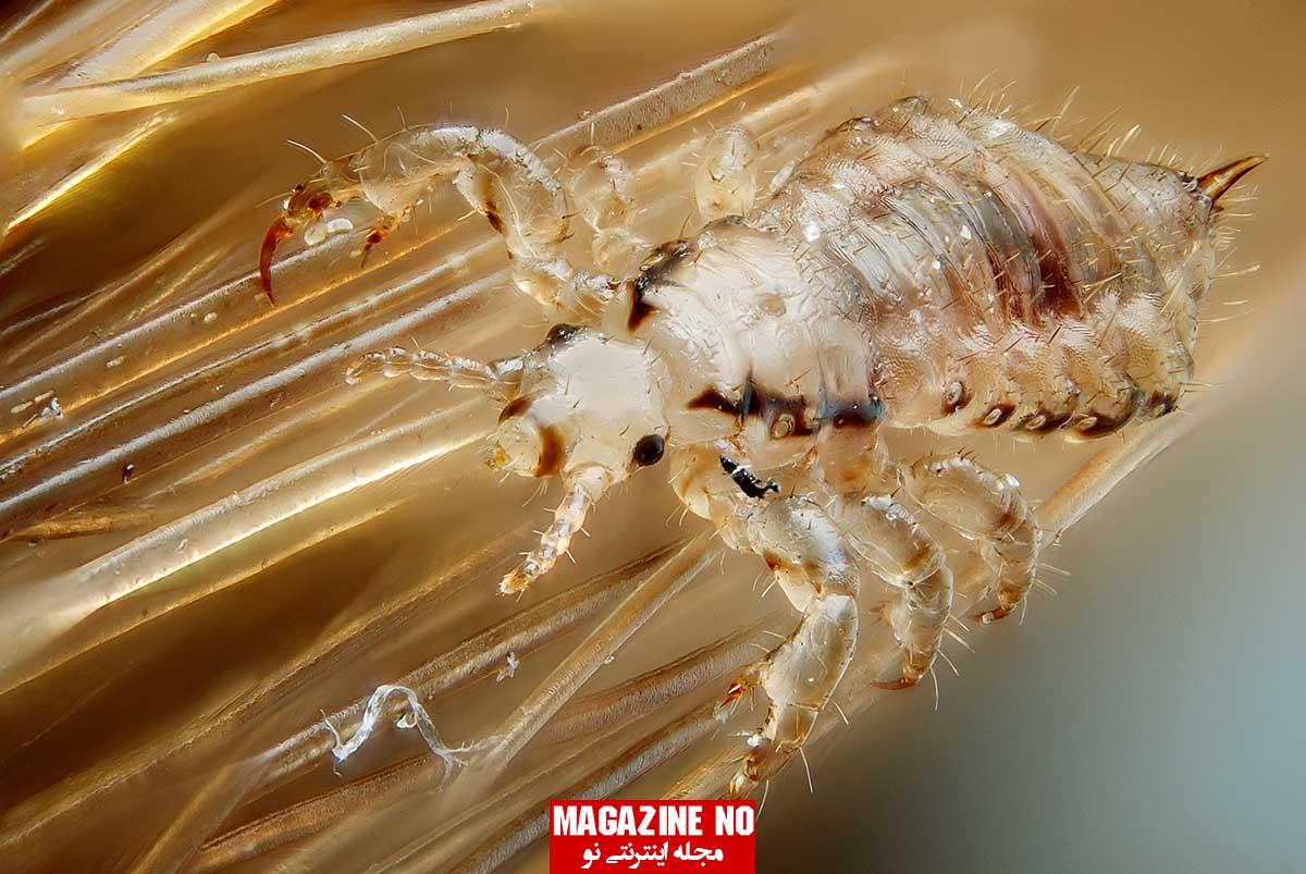 شپش (Louse) + علائم، نشانه‌ها و پیشگیری از آلودگی به شپش