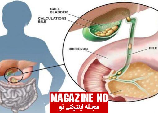 صفرا (Bile) + نقش، ترکیب و اهمیت آن در بدن انسان