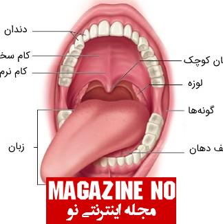 سقف دهان یا کام- شکاف لب و کام در نوزادان چیست؟