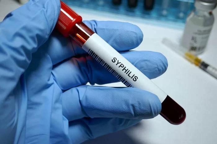 سیفلیس (Syphilis)- راه انتقال بیماری، علائم، پیشگیری و درمان