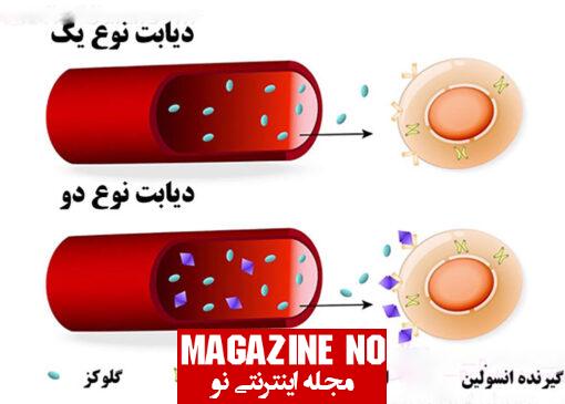 مقایسه روش‌های مختلف درمان دیابت نوع 1 و نوع 2