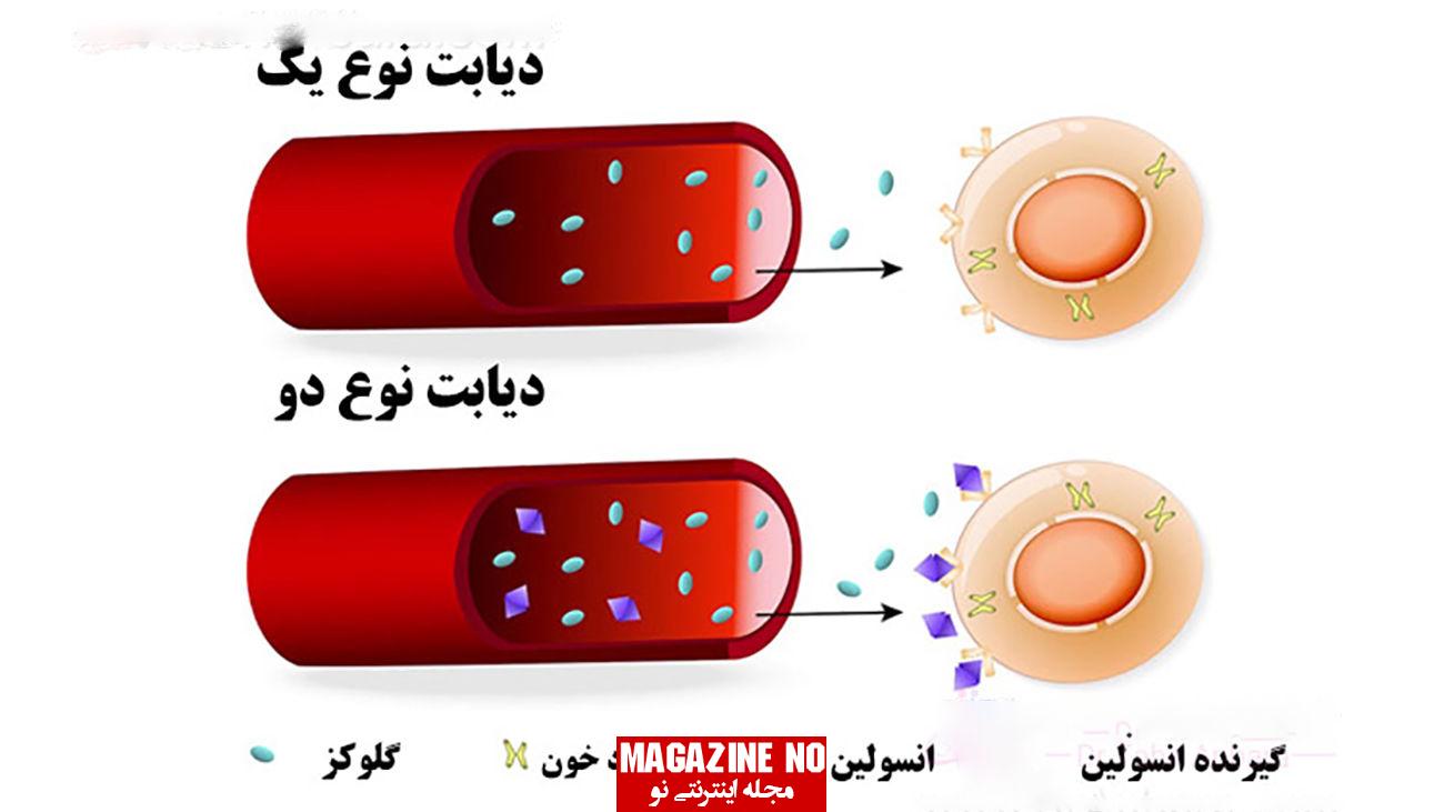 مقایسه روش‌های مختلف درمان دیابت نوع 1 و نوع 2