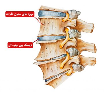 ساخت داربستی برای بافت لیفی دیسک بین مهره‌ای توسط محققان امیرکبیر