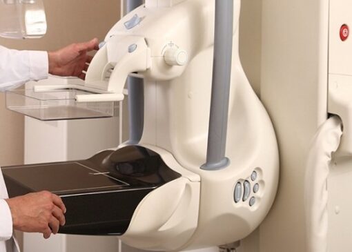 آدرس مراکز ماموگرافی رایگان مشخص شد