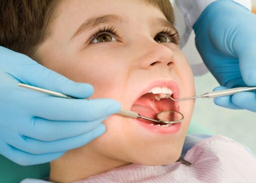 پوسیدگی دندان گریبانگیر ۹۰ درصد کودکان زیر ۷ سال